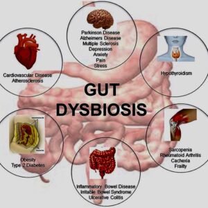 Bowel Flora Restoration (Gut Dysbiosis)