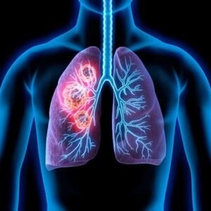 COPD (Chronic Obstructive Pulmonary Disease)