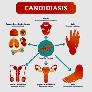 Candida