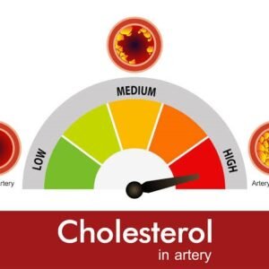 Cholesterol (High)